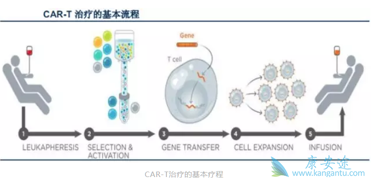 CAR-T