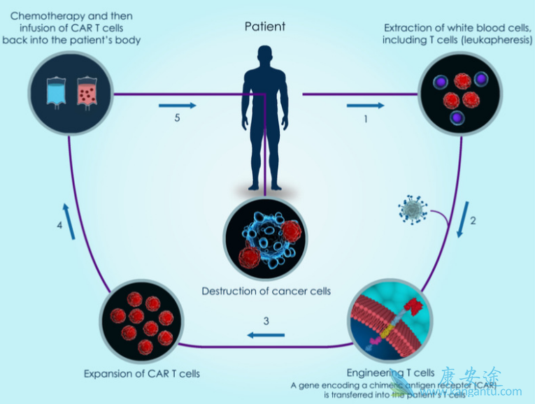 CAR-T