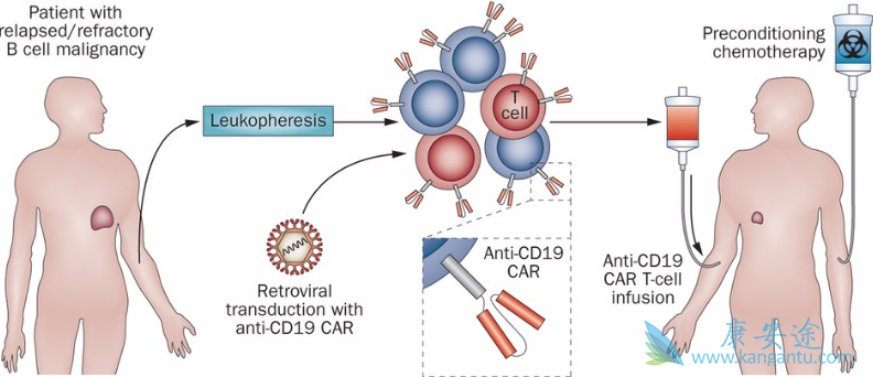 CAR-T