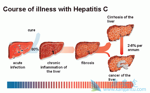 <a href='http://hcv.kangantu.org/' style='color: rgb(0, 176, 240);'></a>